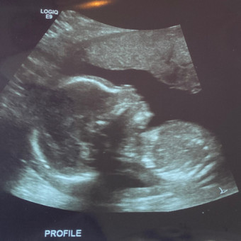 Babylist Registry Photo.