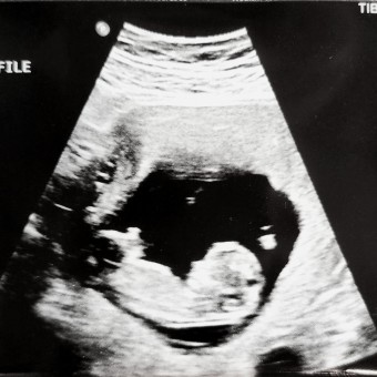 Babylist Registry Photo.