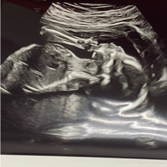 Babylist Registry Photo.