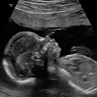 Babylist Registry Photo.