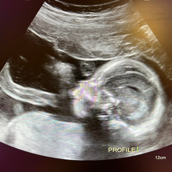 Babylist Registry Photo.