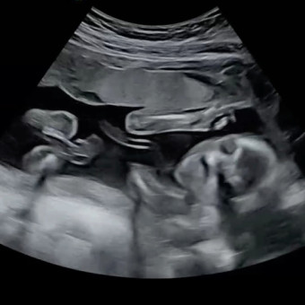 Babylist Registry Photo.