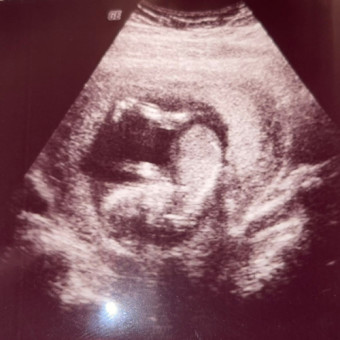 Babylist Registry Photo.