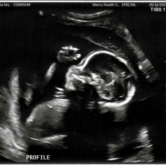 Babylist Registry Photo.