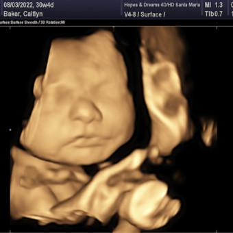 Babylist Registry Photo.