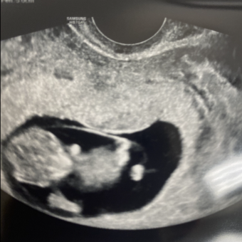 Babylist Registry Photo.