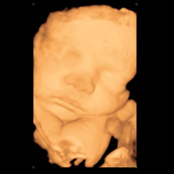 Babylist Registry Photo.