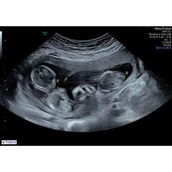 Babylist Registry Photo.