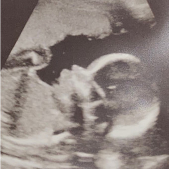 Babylist Registry Photo.