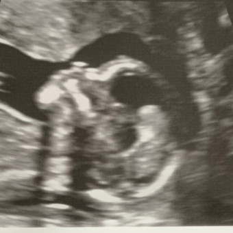 Babylist Registry Photo.