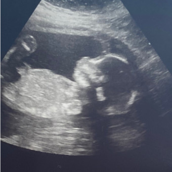 Babylist Registry Photo.