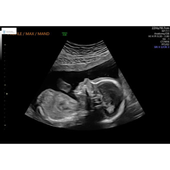 Babylist Registry Photo.