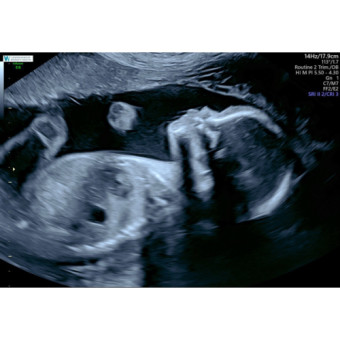 Babylist Registry Photo.