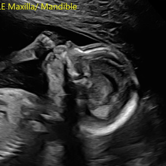 Babylist Registry Photo.