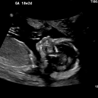 Babylist Registry Photo.