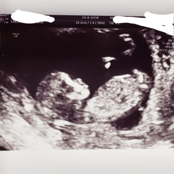 Babylist Registry Photo.
