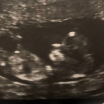 Babylist Registry Photo.