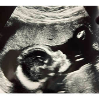 Babylist Registry Photo.