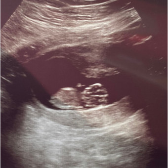 Babylist Registry Photo.
