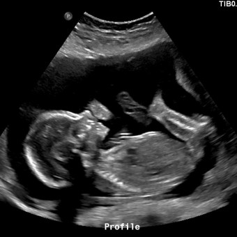 Babylist Registry Photo.