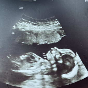 Babylist Registry Photo.