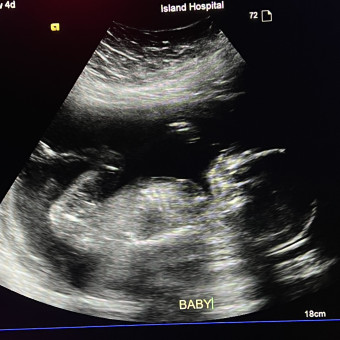 Babylist Registry Photo.