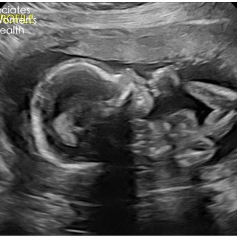 Babylist Registry Photo.