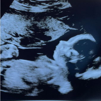 Babylist Registry Photo.