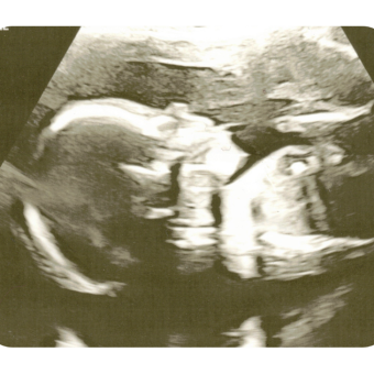 Babylist Registry Photo.