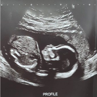Babylist Registry Photo.