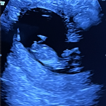 Babylist Registry Photo.