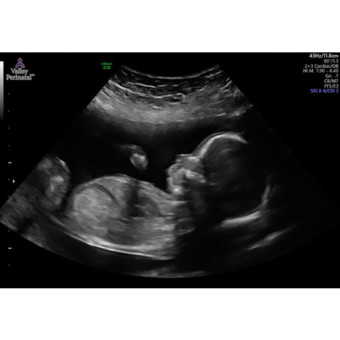 Babylist Registry Photo.