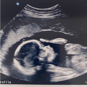 Babylist Registry Photo.