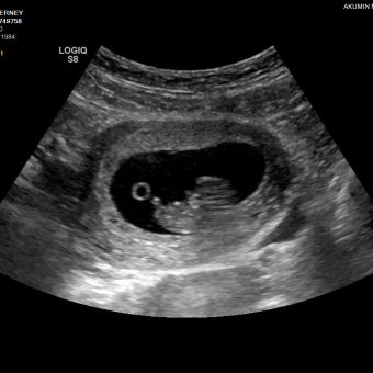 Babylist Registry Photo.