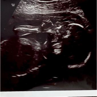 Babylist Registry Photo.