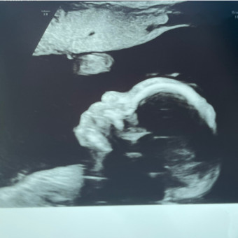 Babylist Registry Photo.