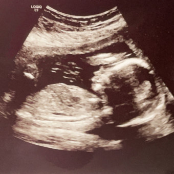 Babylist Registry Photo.