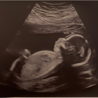 Babylist Registry Photo.
