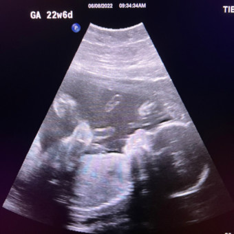 Babylist Registry Photo.