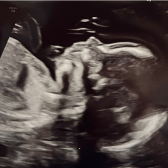 Babylist Registry Photo.