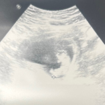 Babylist Registry Photo.