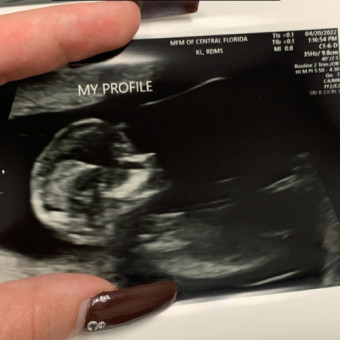 Babylist Registry Photo.