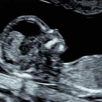 Babylist Registry Photo.