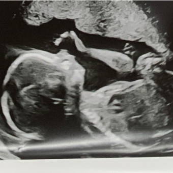 Babylist Registry Photo.