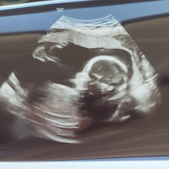 Baby Knox Henry Morgan Photo.