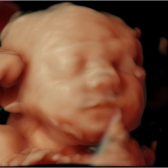 Babylist Registry Photo.