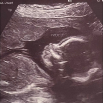 Babylist Registry Photo.