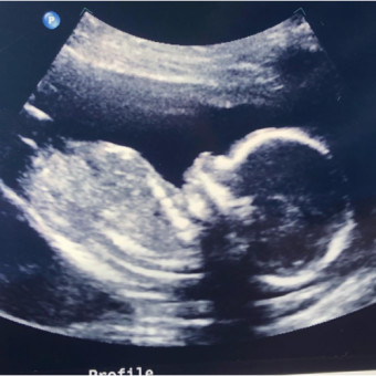 Babylist Registry Photo.