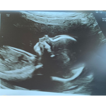 Babylist Registry Photo.