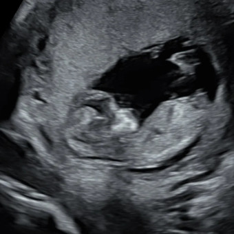 Babylist Registry Photo.